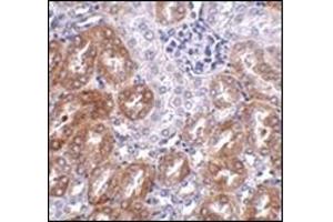 Immunohistochemistry of LIAR in mouse kidney tissue AP30506PU-N antibody at 2. (ANKRD54 抗体  (C-Term))