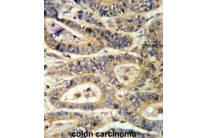 Immunohistochemistry (IHC) image for anti-Insulin-Like Growth Factor Binding Protein 6 (IGFBP6) antibody (ABIN3002791) (IGFBP6 抗体)