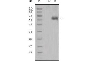 Western blot analysis using DKK1 mouse mAb against HEK293 (1) and DKK1-hIgGFc transfected HEK293 cell lysate (2). (DKK1 抗体)