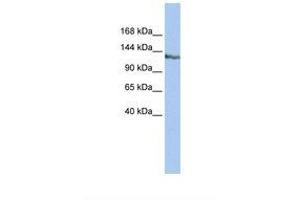 Image no. 1 for anti-SWI/SNF-Related, Matrix-Associated Actin-Dependent Regulator of Chromatin, Subfamily A, Containing DEAD/H Box 1 (SMARCAD1) (AA 218-267) antibody (ABIN6737754) (SMARCAD1 抗体  (AA 218-267))