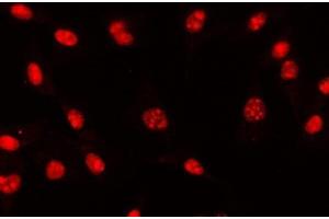 IF analysis of AREB6/ZEB1 using anti-AREB6/ZEB1 antibody (ABIN7602990).