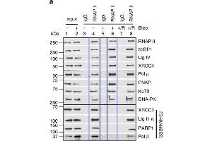 Immunoprecipitation (IP) image for anti-Poly (ADP-Ribose) Polymerase 1 (PARP1) antibody (ABIN2854798)