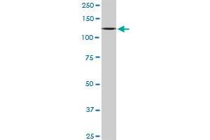 Western Blotting (WB) image for anti-Cullin-Associated and Neddylation-Dissociated 1 (CAND1) (AA 1-100) antibody (ABIN527718)