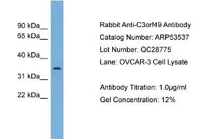 WB Suggested Anti-C3orf49  Antibody Titration: 0. (C3orf49 抗体  (Middle Region))
