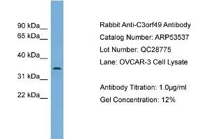 WB Suggested Anti-C3orf49  Antibody Titration: 0. (C3orf49 抗体  (Middle Region))
