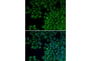 Immunofluorescence analysis of HeLa cells using NUDT6 antibody. (NUDT6 抗体)
