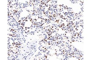Immunohistochemistry (Paraffin-embedded Sections) (IHC (p)) image for anti-Matrix Metallopeptidase 9 (Gelatinase B, 92kDa Gelatinase, 92kDa Type IV Collagenase) (MMP9) antibody (ABIN7249784)
