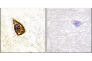 Immunohistochemistry analysis of paraffin-embedded human brain tissue, using Trk B (Ab-705) Antibody. (TRKB 抗体  (AA 671-720))
