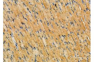 ABIN6260907 and ABIN6279340 at 1/100 staining rat muscle tissue by IHC-P. (CNDP2 抗体  (C-Term))