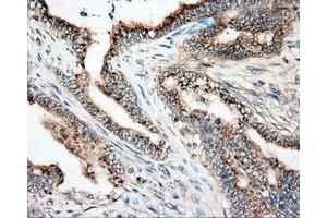 Immunohistochemical staining of paraffin-embedded liver tissue using anti-NIT2 mouse monoclonal antibody. (NIT2 抗体)