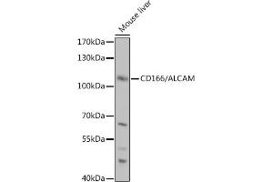 Western blot analysis of extracts of Mouse liver, using CD166/CD166/ALCAM antibody (ABIN6127405, ABIN6136759, ABIN6136760 and ABIN6219454) at 1:1000 dilution. (CD166 抗体  (AA 28-180))