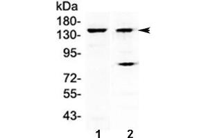 Western blot testing of 1) mouse liver and 2) human A431 lysate with FBXL11 antibody at 0. (KDM2A 抗体)