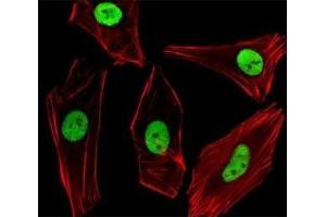 Fluorescent image of SH-SY5Y cells stained with SUMO2/3 antibody diluted at 1:100 dilution. (SUMO2/3 抗体  (AA 49-81))