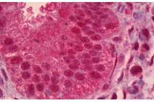 Anti-PAX9 antibody IHC staining of human uterus, endometrium. (PAX9 抗体)