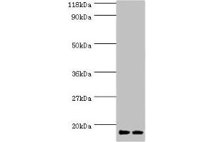 Western blot All lanes: RPS19 antibody at 2 μg/mL Lane 1: EC109 whole cell lysate Lane 2: 293T whole cell lysate Secondary Goat polyclonal to rabbit IgG at 1/15000 dilution Predicted band size: 17 kDa Observed band size: 17 kDa (RPS19 抗体  (AA 1-145))