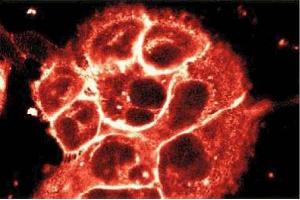 Immunofluorescent staining of A431 cells. (P-Cadherin 抗体  (AA 72-259))