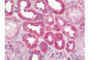 Human Kidney: Formalin-Fixed, Paraffin-Embedded (FFPE)