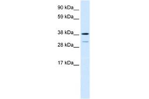 Western Blotting (WB) image for anti-Vacuolar Protein Sorting 72 Homolog (S. Cerevisiae) (VPS72) (Middle Region) antibody (ABIN2778249)