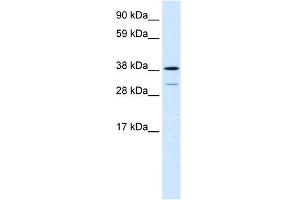 WB Suggested Anti-TCFL1 Antibody Titration:  0. (VPS72 抗体  (Middle Region))