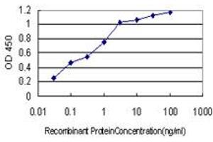 Detection limit for recombinant GST tagged AKR1B10 is approximately 0.