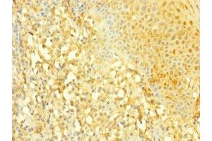 Immunohistochemistry of paraffin-embedded human tonsil tissue using ABIN7169906 at dilution of 1:100 (SLC4A7 抗体  (AA 240-400))