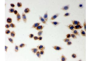 IHC analysis of LYRIC using anti-LYRIC antibody . (MTDH 抗体  (AA 101-270))