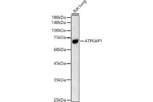 Western blot analysis of extracts of Rat lung, using  antibody (ABIN3021729, ABIN3021730, ABIN3021731 and ABIN6215663) at 1:500 dilution. (ATP6AP1 抗体  (AA 90-390))