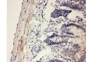 IHC-P testing of rat intestine tissue (COX1 抗体  (AA 318-599))