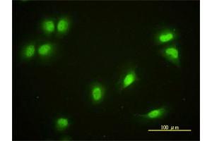 Immunofluorescence of monoclonal antibody to CRY1 on HeLa cell. (CRY1 抗体  (AA 1-586))