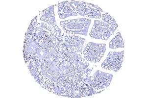 CD22 positive B lymphocytes are rare in this sample of ileum mucosa (Recombinant CD22 抗体  (AA 52-178))