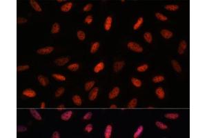 Immunofluorescence analysis of U-2 OS cells using ARID1B Polyclonal Antibody at dilution of 1:100. (ARID1B 抗体)