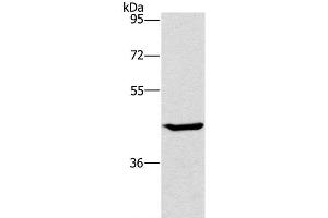 Western Blot analysis of HT-29 cell using GCK Polyclonal Antibody at dilution of 1:450 (GCK 抗体)