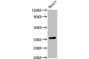 Western Blot Positive WB detected in: Rat heart tissue All lanes: NMI antibody at 3. (NMI 抗体  (AA 62-202))