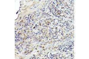 Immunohistochemistry of paraffin-embedded human tonsil using IL6R Rabbit pAb (ABIN3015521, ABIN3015522, ABIN3015523, ABIN1680455 and ABIN6218635) at dilution of 1:50 (40x lens). (IL-6 Receptor 抗体  (AA 20-320))