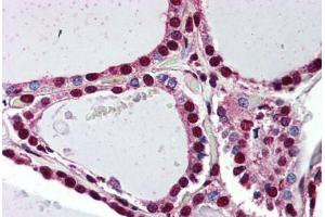 Anti-PROKR2 antibody  ABIN1049246 IHC staining of human thyroid. (Prokineticin Receptor 2 抗体  (N-Term))