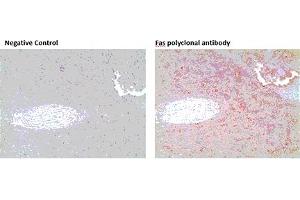 Immunohistochemistry analysis of formalin-fixed, paraffin-embedded human spleen tissue stained with Fas polyclonal antibody,  at 10 μg/mL. (FAS 抗体)