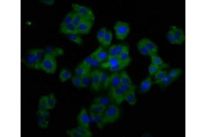Immunofluorescence staining of HepG2 cells with ABIN7173864 at 1:200, counter-stained with DAPI. (TNFRSF19 抗体  (AA 276-415))