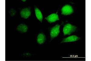 Immunofluorescence of purified MaxPab antibody to PSMB8 on HeLa cell. (PSMB8 抗体  (AA 1-272))