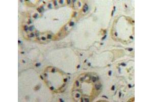 IHC-P analysis of Kidney tissue, with DAB staining. (PLA2R1 抗体  (AA 385-643))