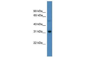 WB Suggested Anti-LBX1  Antibody Titration: 0. (Lbx1 抗体  (N-Term))