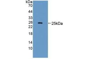 Detection of Recombinant LAMb3, Mouse using Polyclonal Antibody to Laminin Beta 3 (LAMb3) (Laminin beta 3 抗体  (AA 367-568))
