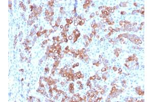 Formalin-fixed, paraffin-embedded human Adrenal stained with TIM3 Mouse Monoclonal Antibody (TIM3/3113). (TIM3 抗体  (AA 22-202))