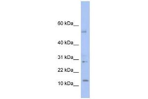 TD1 antibody used at 1 ug/ml to detect target protein. (TLX1 Neighbor 抗体  (Middle Region))