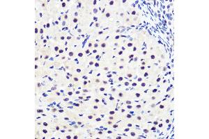 Immunohistochemistry (IHC) image for anti-Nuclear Factor of kappa Light Polypeptide Gene Enhancer in B-Cells Inhibitor, alpha (NFKBIA) (pSer36) antibody (ABIN7268992)