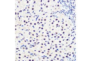 Immunohistochemistry of paraffin-embedded rat ovary using Phospho-IκBα-S36 Rabbit mAb (ABIN7268992) at dilution of 1:100 (40x lens). (NFKBIA 抗体  (pSer36))