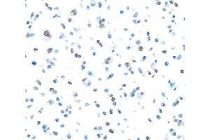 Immunocytochemistry (ICC) image for anti-Poly (ADP-Ribose) Polymerase 1 (PARP1) (AA 750-800) antibody (ABIN7449531) (Recombinant PARP1 抗体  (AA 750-800))