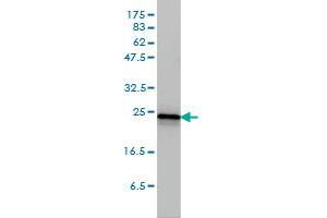 RRAS2 monoclonal antibody (M01A), clone 2D3-4B8 Western Blot analysis of RRAS2 expression in A-431 . (RRAS2 抗体  (AA 1-204))