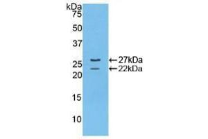 Detection of Recombinant FBN1, Mouse using Polyclonal Antibody to Fibrillin 1 (FBN1) (Fibrillin 1 抗体  (AA 1703-1889))