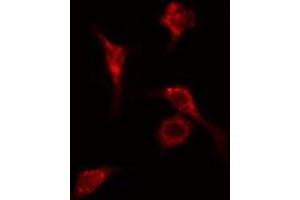 ABIN6278632 staining Hela cells by IF/ICC. (RPL14 抗体  (Internal Region))