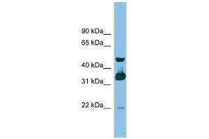 GBL antibody used at 1 ug/ml to detect target protein. (GBL 抗体)